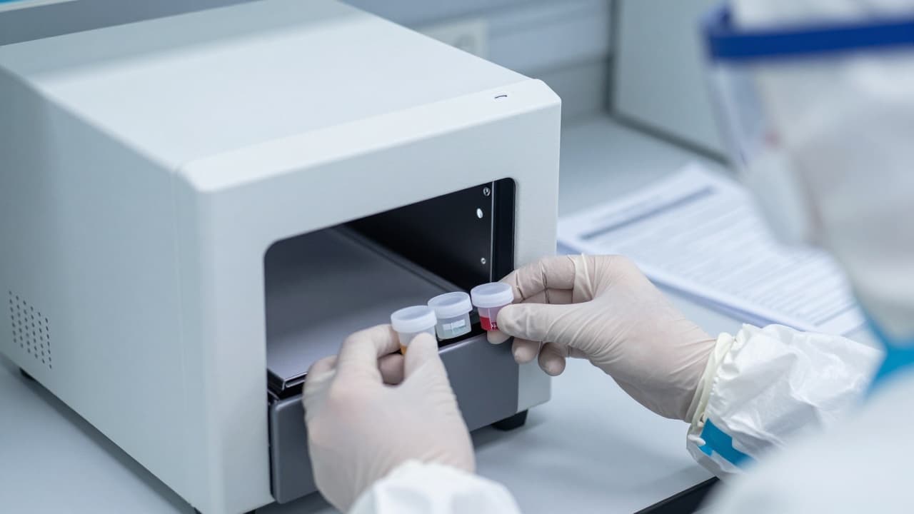 Gloves hold a vial in a PCR laboratory
